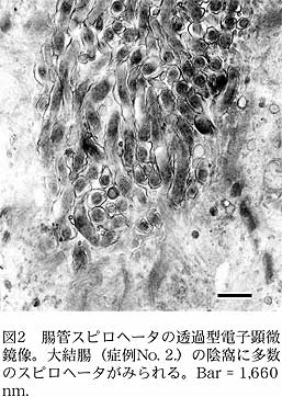 図2 腸管スピロヘータの透過型電 子顕微鏡像。