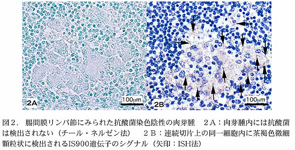 図2. 腸間膜リンパ節にみられた抗酸菌染色陰性の肉芽腫 2A:肉芽腫内には抗酸菌は検出されない(チール・ネルゼン法) 2B:連続切片上の同一細胞内に茶褐色微細顆粒状に検出されるIS900遺伝子のシグナル(矢印:ISH法)