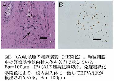 図2 (A)乳頭腫の組織病変(HE染色)。顆粒細胞中の好塩基性核内封入体を矢印で示している。Bar=100?m (B) (A)の連続組織切片。免疫組織化学染色により、核内封入体に一致してBPV抗原が検出されている。Bar=100?m