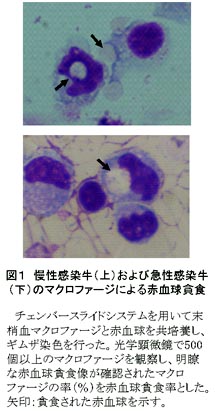 図1 慢性感染牛(上)および急性感染牛(下)のマクロファージによる赤血球貪食