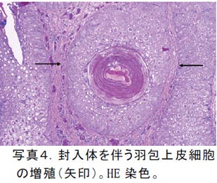 写真4.封入体を伴う羽包上皮細胞の増殖(矢印)。HE染色。