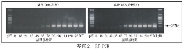 写真2 RT-PCR