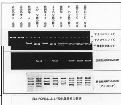 図2 PCR法によるY染色体異常の診断