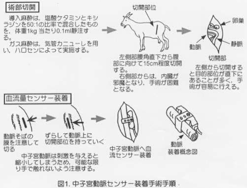 図1.中子宮動脈センサー装着手術手順