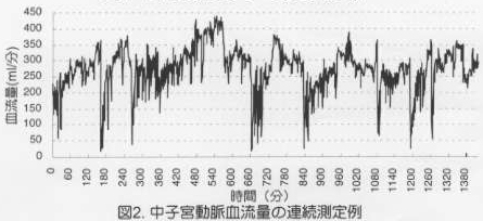 図2.中子宮動脈血流量の連続測定例