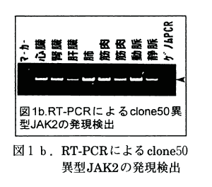 図1b RT-PCRによるclone50異型JAK2の発現検出