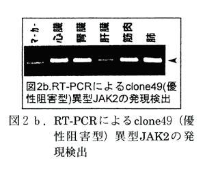図2b RT-PCRによるclone49(優性阻害型)異型JAK2の発現検出