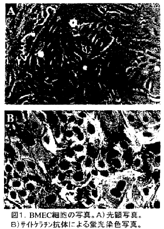 図1 BMEC細胞の写真。A)光顕写真。B)サイトケラチン抗体による蛍光染色写真。