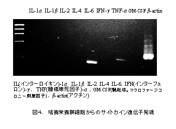 図4 培養栄養膜細胞からのサイトカイン遺伝子発現