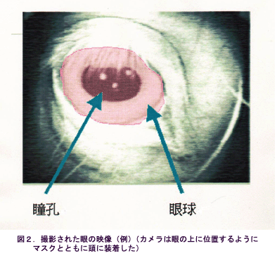 図2 撮影された眼の映像(例)