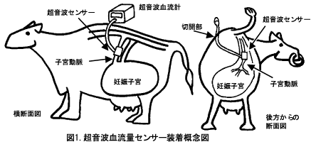 図1 超音波血流量センサー装着概念図