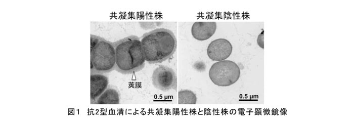 図1 抗2型血清による共凝集陽性株と陰性株の電子顕微鏡像