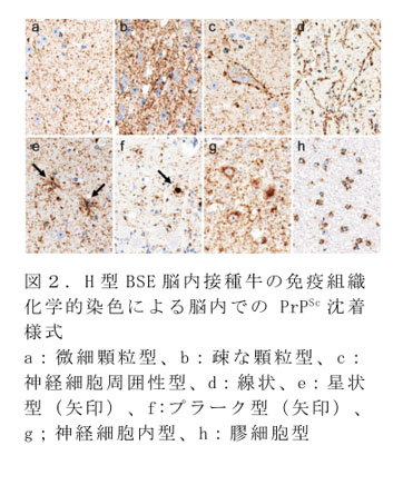 図2. H型BSE脳内接種牛の免疫組織化学的染色による脳内でのPrPSc沈着様式
