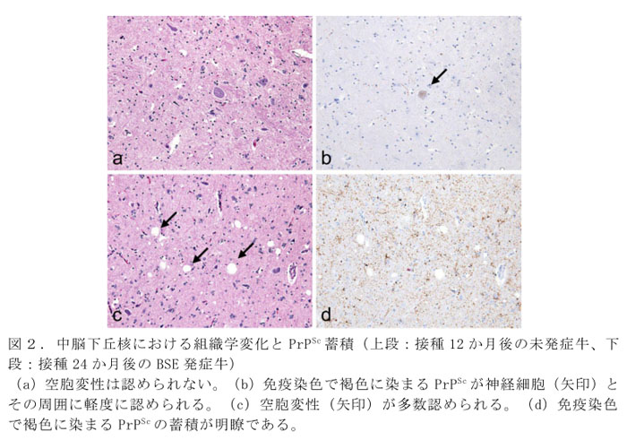 図2. 中脳下丘核における組織学変化とPrPSc蓄積(上段:接種12か月後の未発症牛、下段:接種24か月後のBSE発症牛)