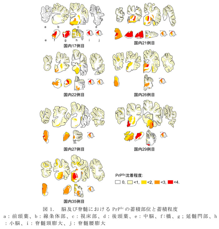 図1. 脳及び脊髄におけるPrPScの蓄積部位と蓄積程度