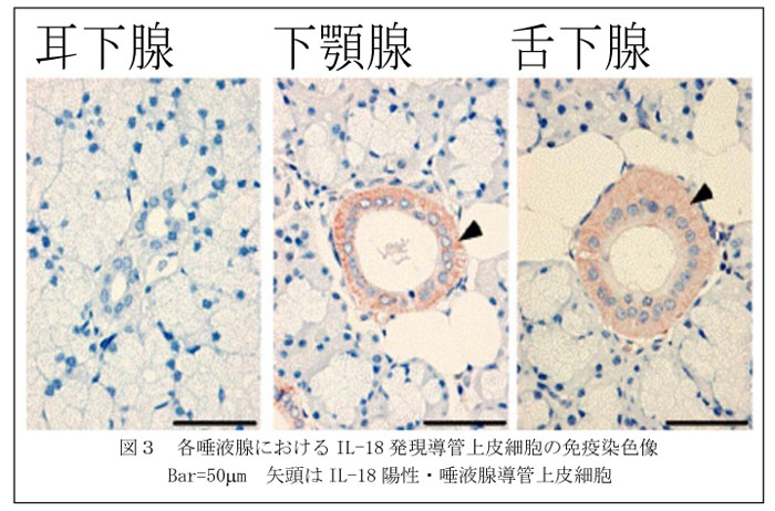 図3 各唾液腺におけるIL-18発現導管上皮細胞の免疫染色像