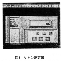 図4 ケトン測定器