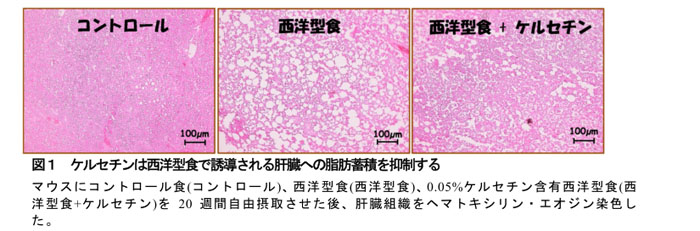 図1 ケルセチンは西洋型食で誘導される肝臓への脂肪蓄積を抑制する