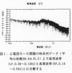 図1 心電図R-R間隔感覚の時系列データ