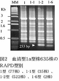 図2 血清型1a型株635株のRAPD型別