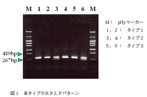 図1 各タイプのRFLPパターン