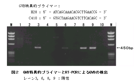 図2 GVB特異的プライマーとRT-PCRによるGVBの検出