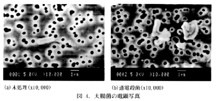 図4 大腸菌の電顕写真