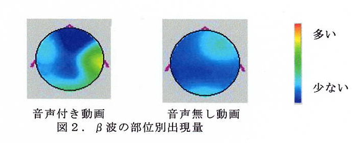 図2 β波の部位別出現量