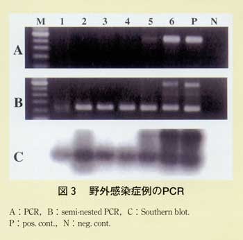 図3 野外感染症例のPCR