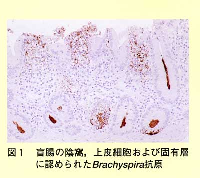 図1 盲腸の陰窩、上皮細胞および固有層に認められたBrachyspiral抗原