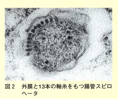 図2 外膜と13本の軸糸をもつ腸管スピロヘータ