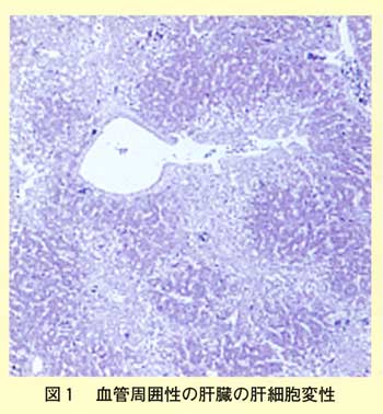 図1 血管周囲性の肝臓の肝細胞変性