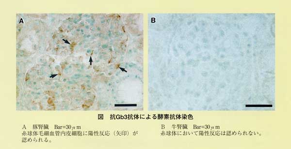 図 抗Gb3抗体による酵素抗体染色