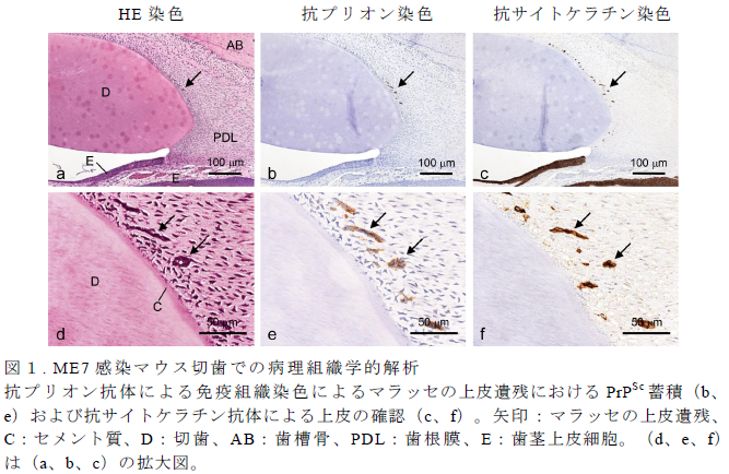 図1.ME7 感染マウス切歯での病理組織学的解析