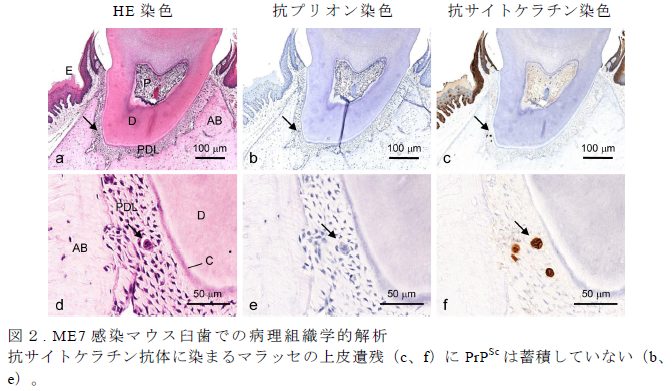 図2.ME7 感染マウス臼歯での病理組織学的解析