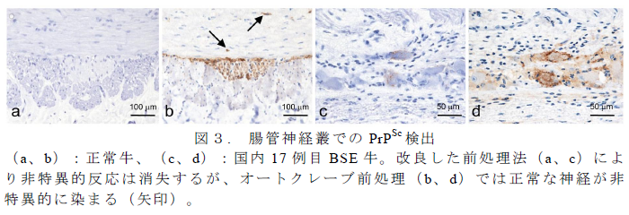 図3.腸管神経叢でのPrPSc 検出