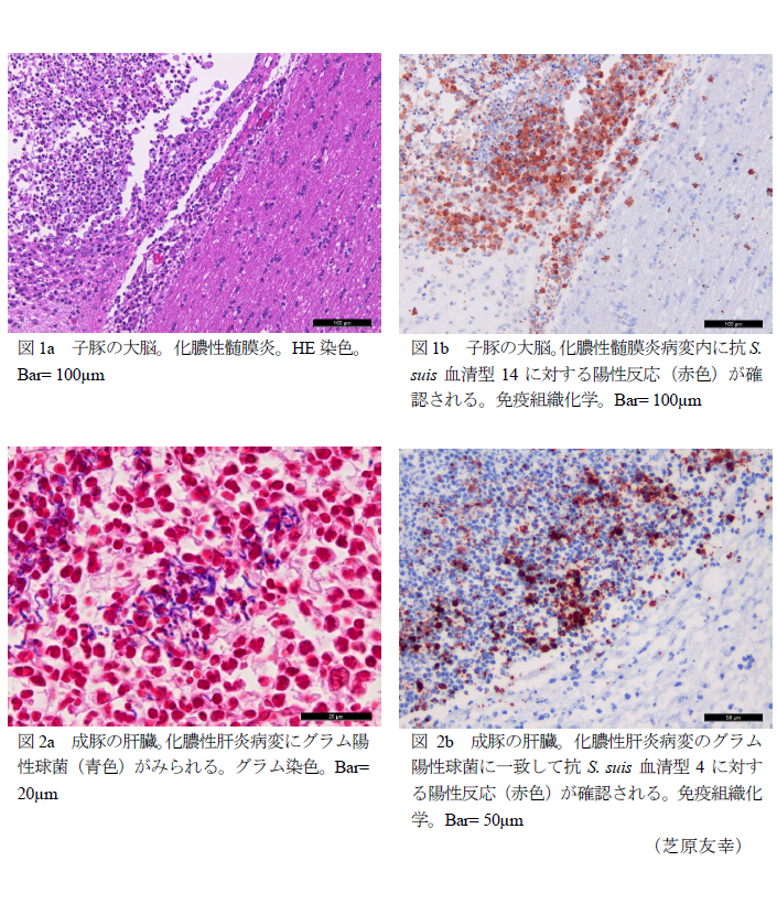 図1a 子豚の大脳。化膿性髄膜炎,図1b 子豚の大脳。化膿性髄膜炎病変内に抗S. suis血清型14に対する陽性反応(赤色)が確認される,図2a 成豚の肝臓。化膿性肝炎病変にグラム陽性球菌(青色)がみられる,図2b 成豚の肝臓。化膿性肝炎病変のグラム陽性球菌に一致して抗S. suis血清型4に対する陽性反応(赤色)が確認される