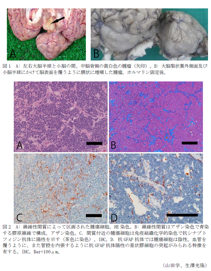 図1 A: 左右大脳半球と小脳の間、中脳背側の黄白色の腫瘤(矢印)。B: 大脳梨状葉外側面及び小脳半球にかけて脳表面を覆うように膜状に増殖した腫瘤。ホルマリン固定後。,図2 A: 線維性間質によって区画された腫瘍細胞。HE染色。B: 線維性間質はアザン染色で青染する膠原線維で構成。アザン染色。C. 間質付近の腫瘍細胞は免疫組織化学的染色で抗シナプトフィジン抗体に陽性を示す(茶色に染色)。IHC。D. 抗GFAP抗体では腫瘍細胞は陰性。血管を覆うように、また管腔を内張するように抗GFAP抗体陽性の星状膠細胞の突起がみられる特徴を有する。IHC。