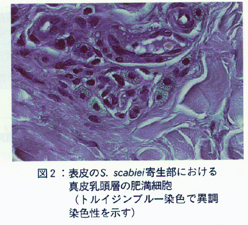 図2.表皮のS.scabiei寄生部における真皮乳頭層の肥満細胞
