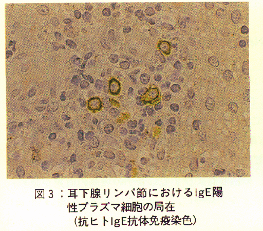 図3.耳下腺リンパ節におけるIgE陽性プラズマ細胞の局在