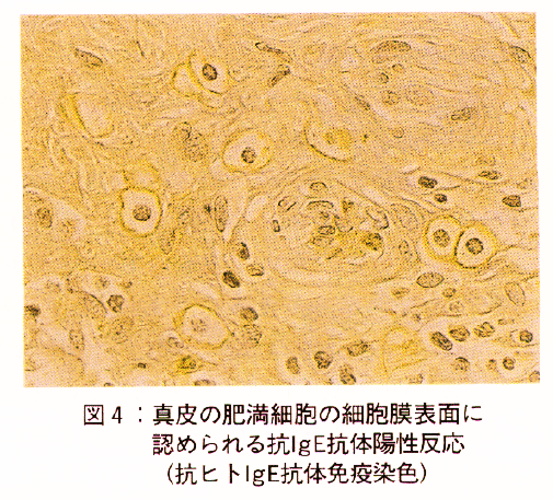 図4.真皮の肥満細胞の細胞膜表面に認められる抗IgE抗体陽性反応