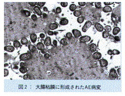 図2.大腸粘膜に形成されたAE病変