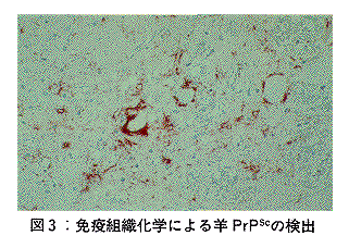 図3 免疫組織化学による羊PrPscの検出