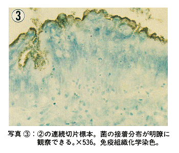 写真3 写真2の連続切片標本