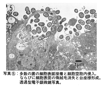 写真5 多数の菌の細胞表面接着と細胞空胞内侵入