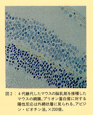 図2 4代継代したマウスの脳乳剤を接種したマウスの網膜