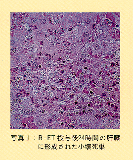 写真1 R-ET投与後24時間の肝臓に形成された小壊死巣