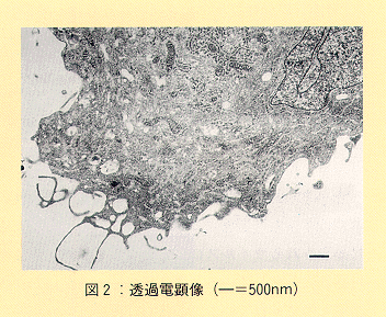 図2 透過電顕像