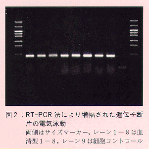 図2 a)RT-PCR法により増幅された遺伝子断片の電気泳動