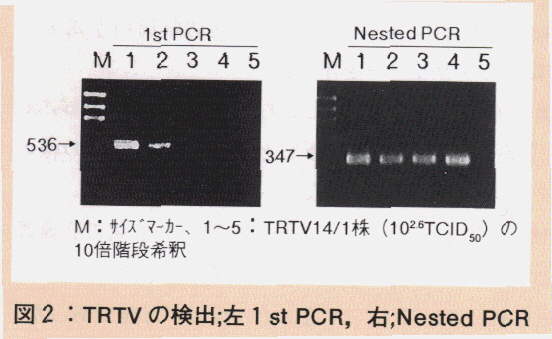 図2.TRTVの検出